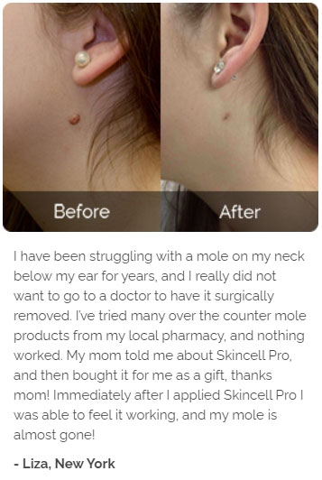Liza's review of Skincell Pro