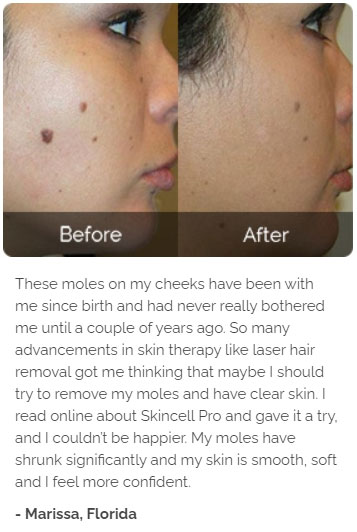 Marissa's review of Skincell Pro